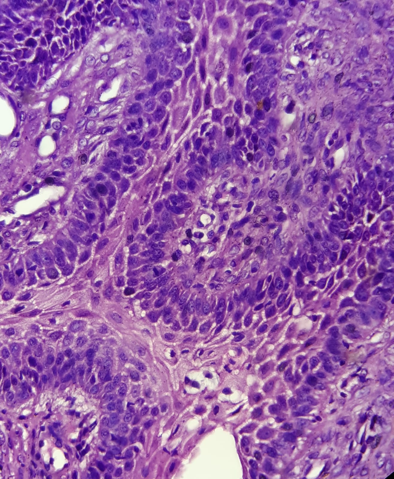 Histopatologia